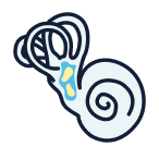 Benign Paroxysmal Positional Vertigo