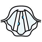 Vocal Nodules (We do not treat this medical condition)